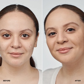 Even Better Clinical&trade; Serum Foundation SPF20
