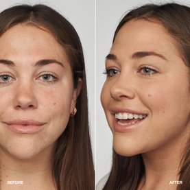 Even Better Clinical&trade; Serum Foundation SPF20