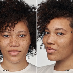 Even Better Clinical&trade; Serum Foundation SPF20