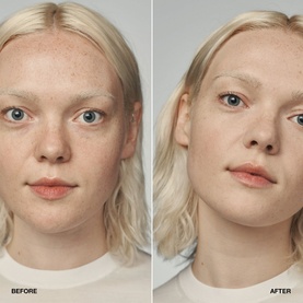 Even Better Clinical&trade; Serum Foundation SPF20