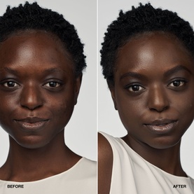 Clinique Even Better Clinical Serum Foundation SPF20 before and after complexion comparison showing coverage and skin-evening results on model
