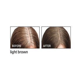 Root Cover Up
