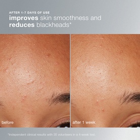 Dermalogica Daily Microfoliant