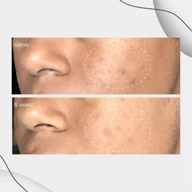 Powerbright Dark Spot Corrector