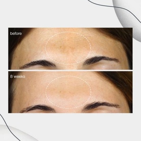 Powerbright Dark Spot Corrector