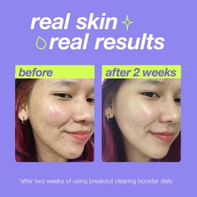 Dermalogica Breakout Clearing Booster 30ml