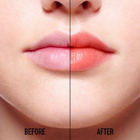 Addict Lip Glow