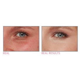 Bye Bye Under Eye Illumination