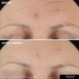 KateCeuticals Firming Serum