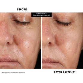 KateCeuticals Resurfacing Overnight Peel