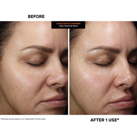 ExfoliKate Cleanser