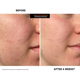 ExfoliKate Intensive