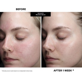 DeliKate Recovery Serum