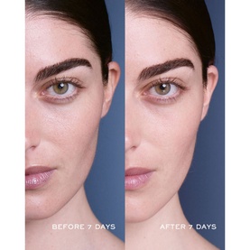 Genifique Serum