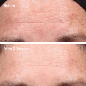Retinol Youth Renewal Serum