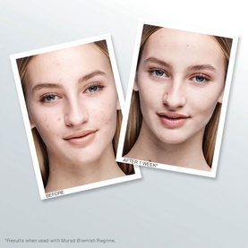 Outsmart Blemish Clarifying Treatment
