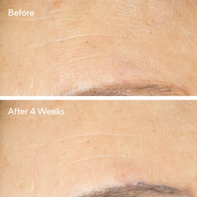 Retinol Youth Renewal Night Cream