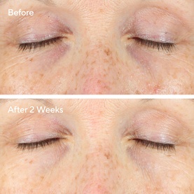 Eye Serum Vita-C Eyes