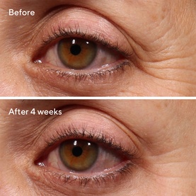 Retinol Youth Renewal Eye Serum