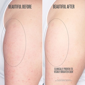 Sol De Janeiro Bom Dia Bright Body Cream before and after showing visibly brighter, more even skin tone on upper arm area.
