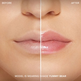 Lip Injection Maximum Plump