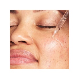 Bye Bye Dark Spots Niacinamide Serum