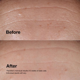 Smart Clinical Repair&trade; Wrinkle Correcting Serum
