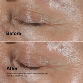 Smart Clinical Repair&trade; Wrinkle Correcting Eye Cream