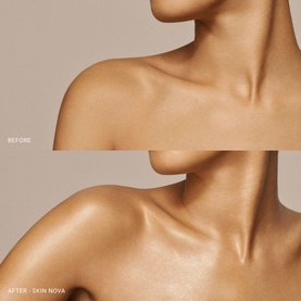 Skin Nova