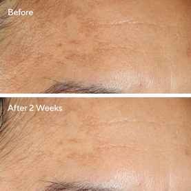 Serum Vita-C Glycolic