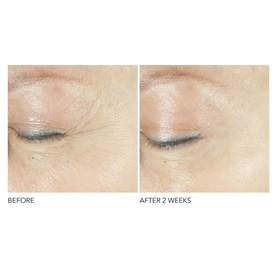 Advanced Retinol + Ferulic Triple Correction Eye Serum