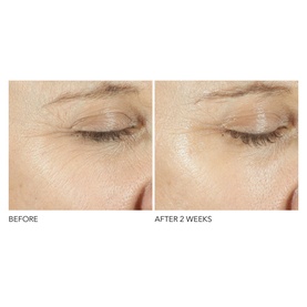 Advanced Retinol + Ferulic Triple Correction Eye Serum