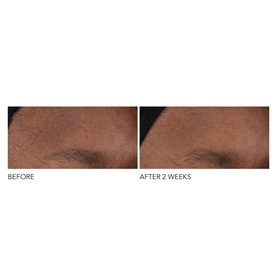 Advanced Retinol + Ferulic Overnight Wrinkle Treatment