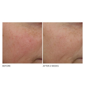 Advanced Retinol + Ferulic Overnight Wrinkle Treatment