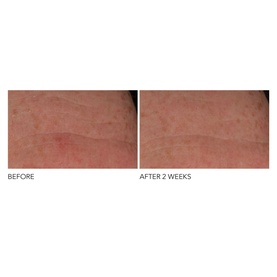 Advanced Retinol + Ferulic Overnight Wrinkle Treatment