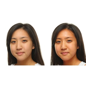 Alpha Beta&reg; Glow Pad&trade; For Face Intense Glow