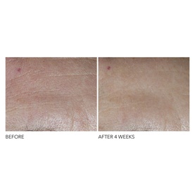 Advanced Retinol + Ferulic Overnight Texture Renewal Peel