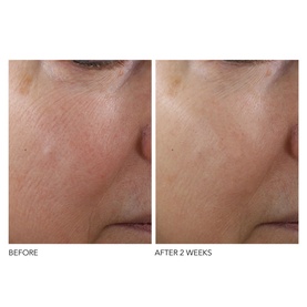 Advanced Retinol + Ferulic Texture Renewal Serum