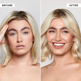 Flaky/Itchy Scalp Anti-Dandruff Toner