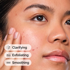 Salicylic Acid 2% Solution