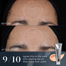 Crystal Retinal 10