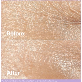 Smart Clinical Repair&trade; Wrinkle Correcting Cream