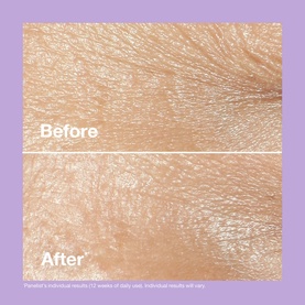 Smart Clinical Repair&trade; Wrinkle Correcting Cream