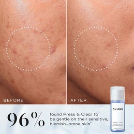 Press & Clear Exfoliating 2% BHA Tonic