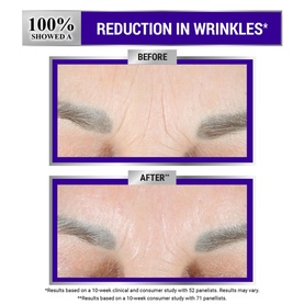 Retinol Fast Release Wrinkle-Reducing Night Serum