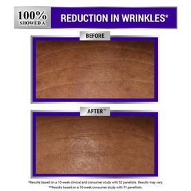 Retinol Fast Release Wrinkle-Reducing Night Serum