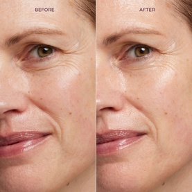 Sculpted by Aimee HydraGlo Serum before and after comparison showing reduced fine lines and improved skin radiance around the eye area.