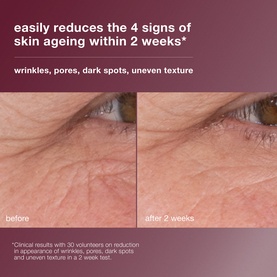 Dynamic Skin Retinol Serum