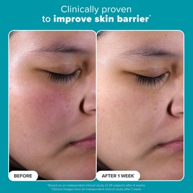 Skin Perfecting 2% BHA Liquid Exfoliant