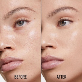 Forever Skin Correct